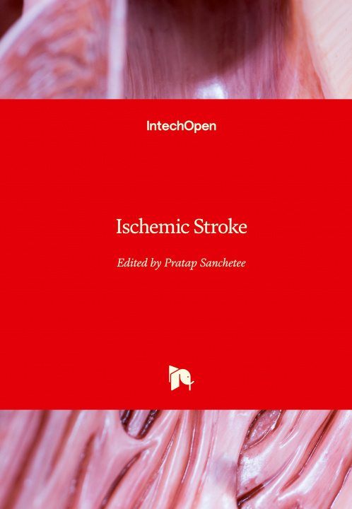 Knjiga Ischemic Stroke Pratap Sanchetee