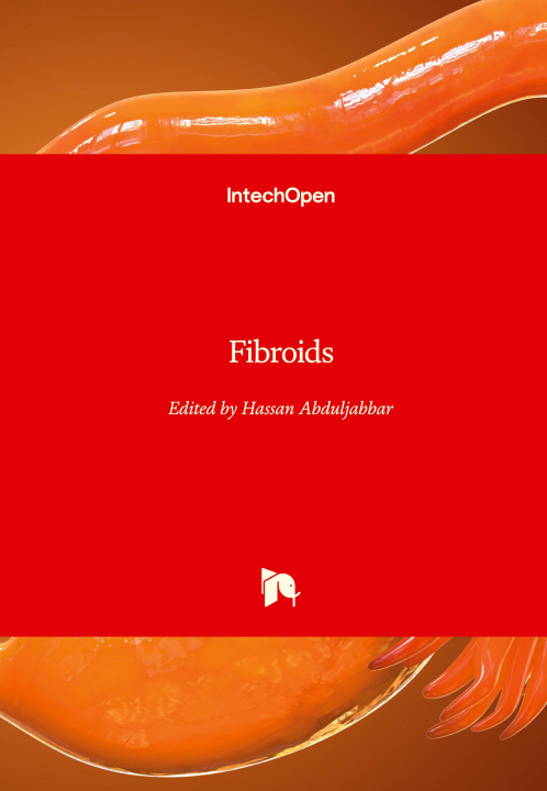 Knjiga Fibroids Hassan Abduljabbar