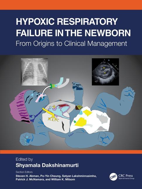 Kniha Hypoxic Respiratory Failure in the Newborn 