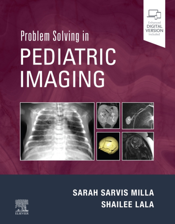 Książka Problem Solving in Pediatric Imaging Sarah Sarvis Milla