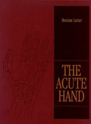 Book ACUTE HAND LESTER