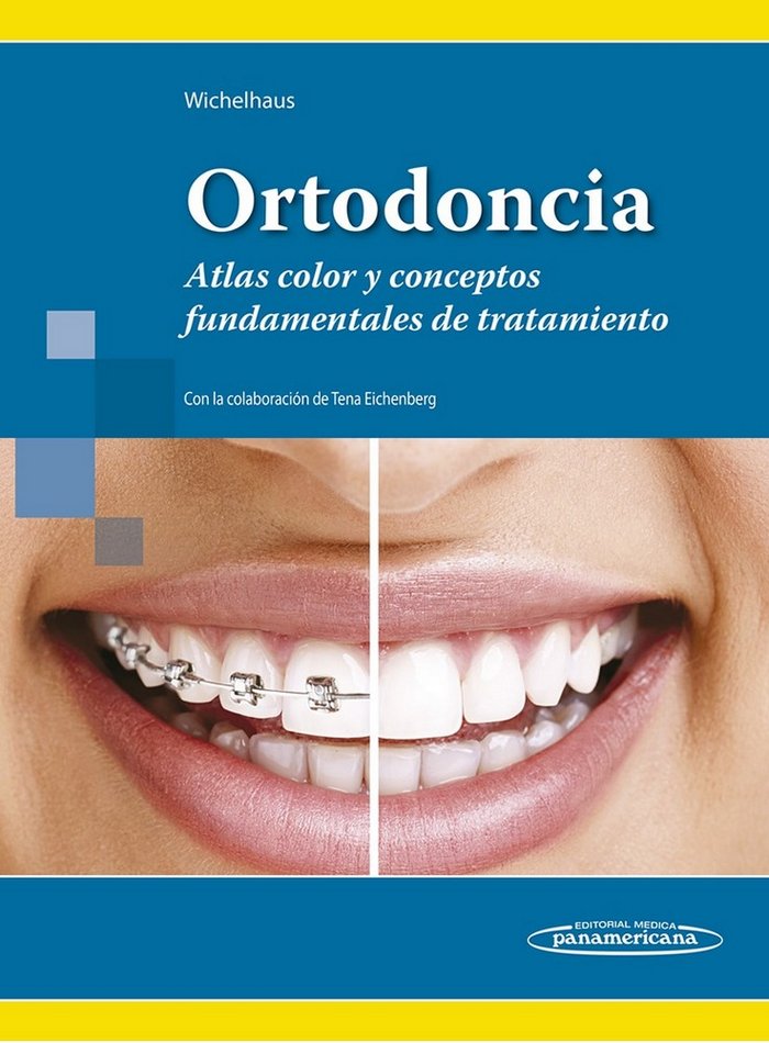 Könyv WICHELHAUS:Ortodoncia Atlas WICHELHAUS