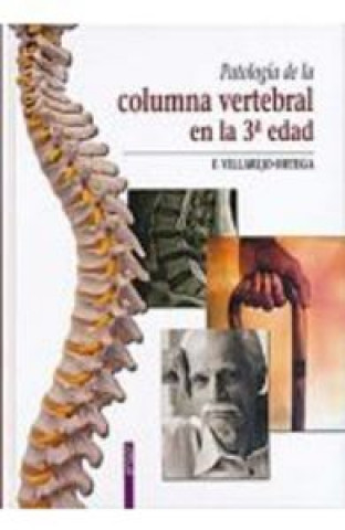 Carte Patolog­a de la columna vertebral en la 3 edad VILLAREJO ORTEGA