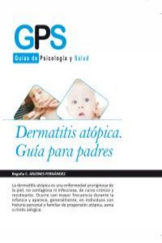 Kniha Dermatitis atópica BEGOñA C.ARJONES FERNáNDEZ