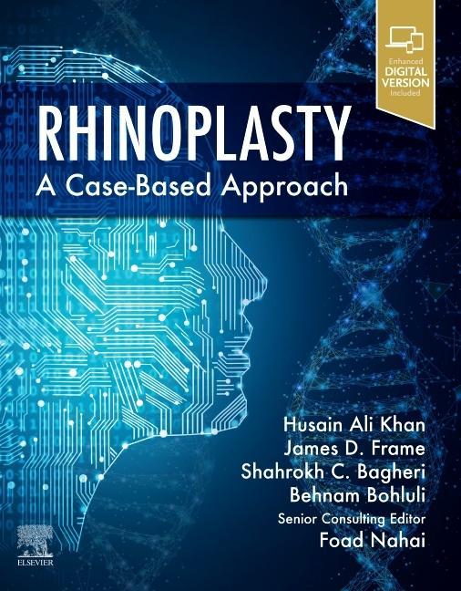 Könyv Rhinoplasty Husain Ali Khan