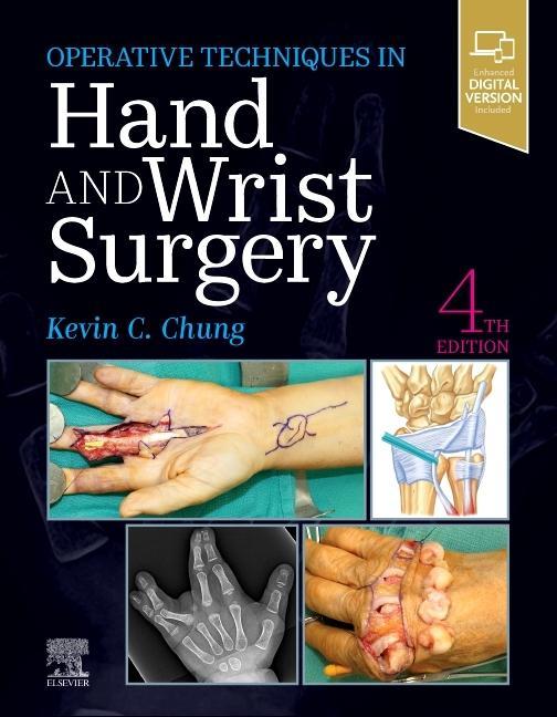 Książka Operative Techniques: Hand and Wrist Surgery Kevin C. Chung