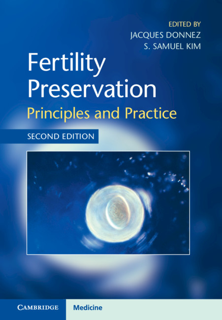 Könyv Fertility Preservation Jacques Donnez