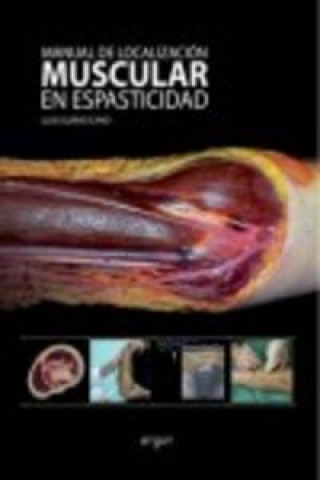 Carte Manual de localización muscular en espasticidad GUIRAO CANO