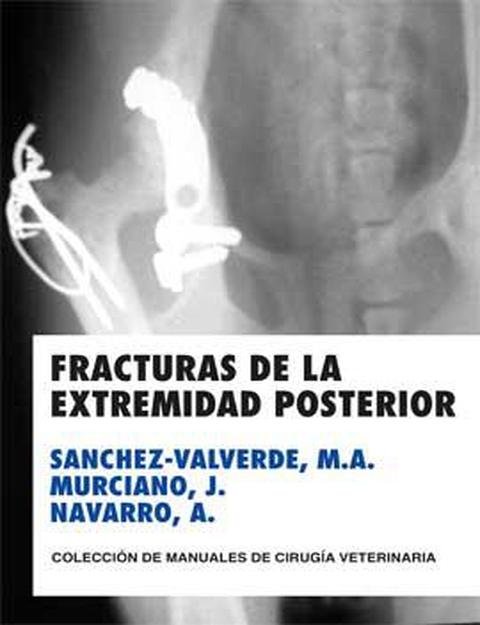 Kniha FRACTURAS DE LA EXTREMIDAD POSTERIOR SANCHEZ-VALVERDE GARCIA
