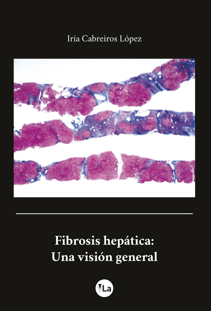 Kniha Fibrosis Hepática: Una visión general Cebreiros López