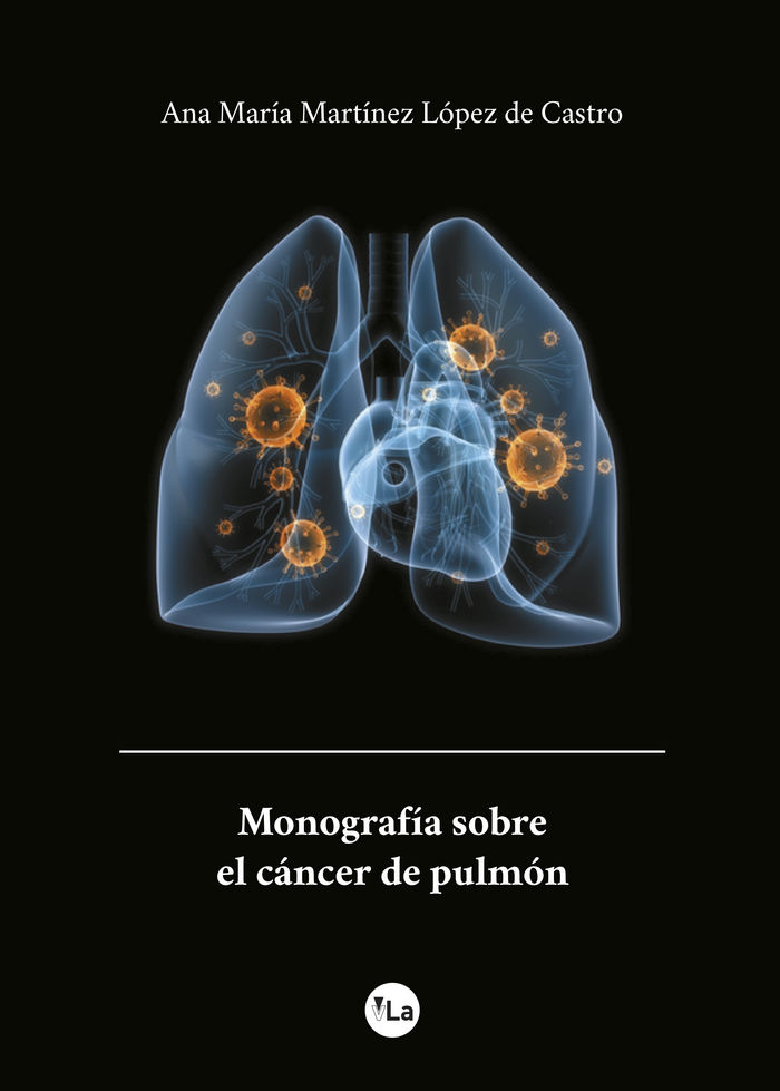 Carte Monografía sobre el cáncer de pulmón Martínez López de Castro