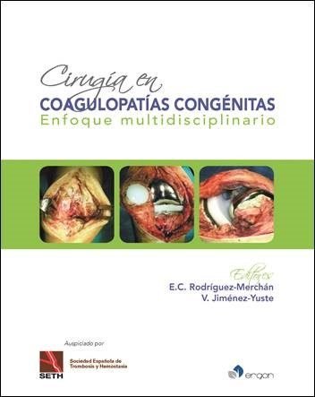 Könyv Cirugía en coagulopatías congénitas Jiménez-Yuste