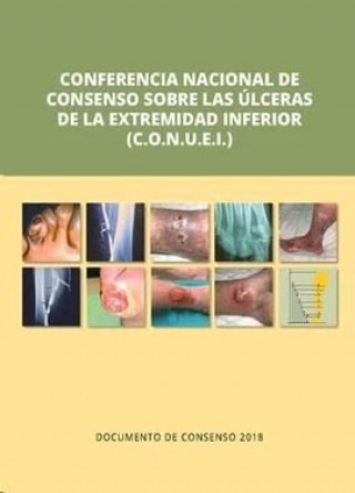 Kniha Conferencia Nacional de Consenso sobre las úlceras de la extremidad inferior (C.O.N.U.E.I). Document Marinel.lo Roura