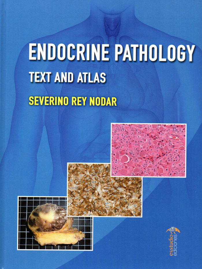 Buch ENDOCRINE PATHOLOGY REY NODAR