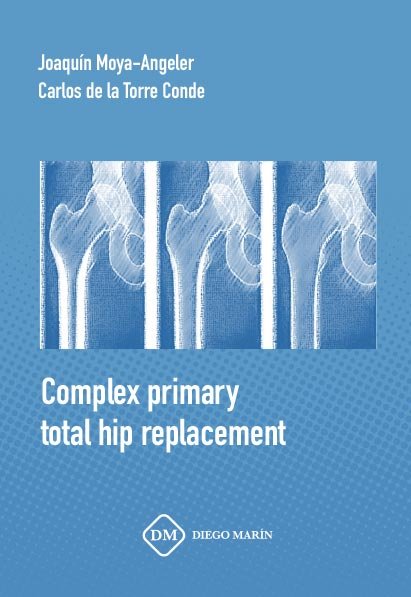 Knjiga COMPLEX PRIMARY TOTAL HIP REPLACEMENT MOYA-ANGELER PEREZ-MATEOS
