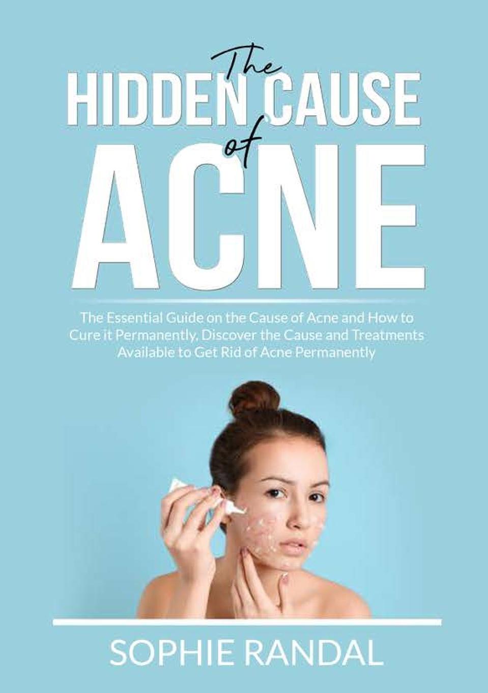 Könyv Hidden Cause of Acne 