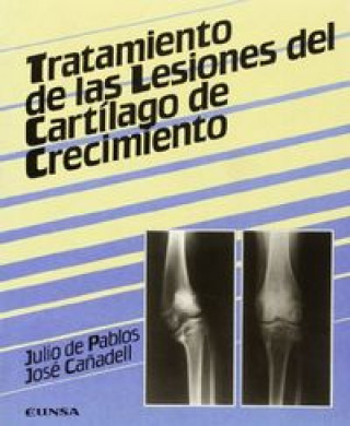 Carte Tratamiento de las lesiones del cartílago de crecimiento Pablos Fernández