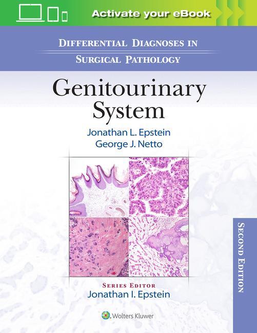Knjiga Differential Diagnoses in Surgical Pathology: Genitourinary System 