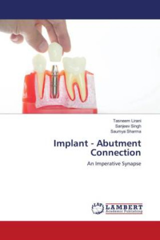 Libro Implant - Abutment Connection TASNEEM LIRANI