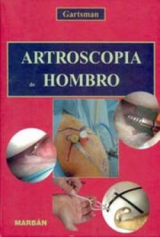 Kniha ARTROSCOPIA DE HOMBRO GARTSMAN