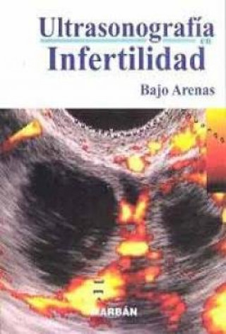 Kniha ECOGRAFIA DE LA INFERTILIDAD BAJO ARENAS