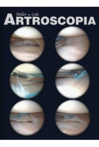 Boek ARTROSCOPIA FLEXILIBRO MILLER