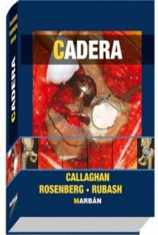 Könyv Cadera CALLAGHAN