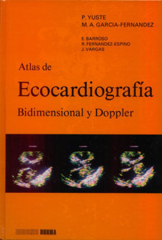Carte Atlas de ecocardiografia bidimensional y doppler Yuste Pescador