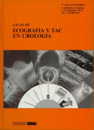 Kniha Atlas de ecografia y TAC en urologia Mayayo Dehesa