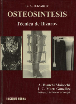 Kniha Osteosintesis Ilizarov