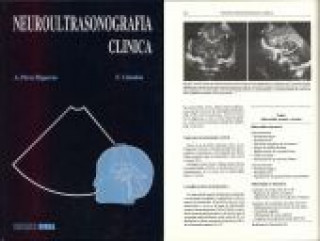 Könyv Neuroultrasonografia clinica Perez Higueras