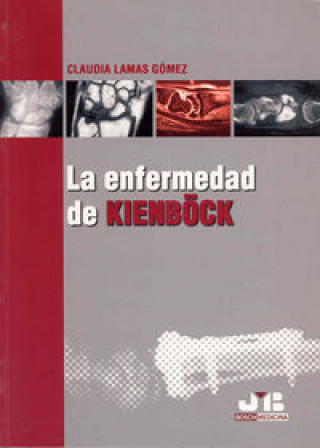 Knjiga La enfermedad de Kienböck. Lamas Gómez