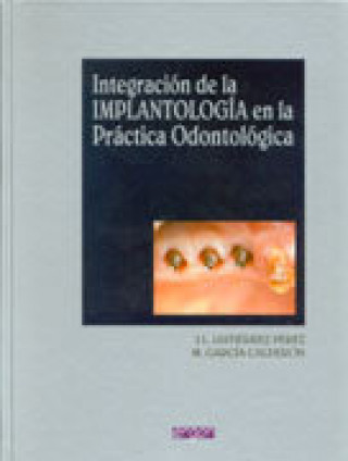 Kniha Integración de la implantolog­a en la práctica odontológica GUTIERREZ PEREZ