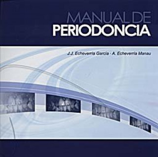 Kniha Manual de periodoncia ECHEVERRIA GARCIA