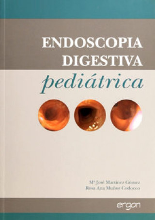 Buch Endoscopia digestiva pediátrica MARTINEZ GOMEZ