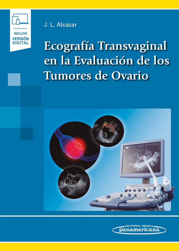 Könyv Ecografía Transvaginal en la Evaluación de los Tumores de Ovario (incluye versión digital) Alcázar Zambrano