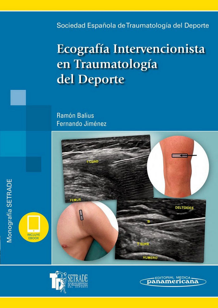 Carte SETRADE:Ecografia Interv.Traum.Deporte+e SETRADE SOCIEDAD ESPAÑOLA DE TRAUMATOLOGIA DEL DEP