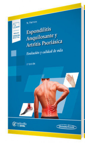 Kniha Espondilitis Anquilosantes y Artritis Psriásica+versión digital Palmau Fontana