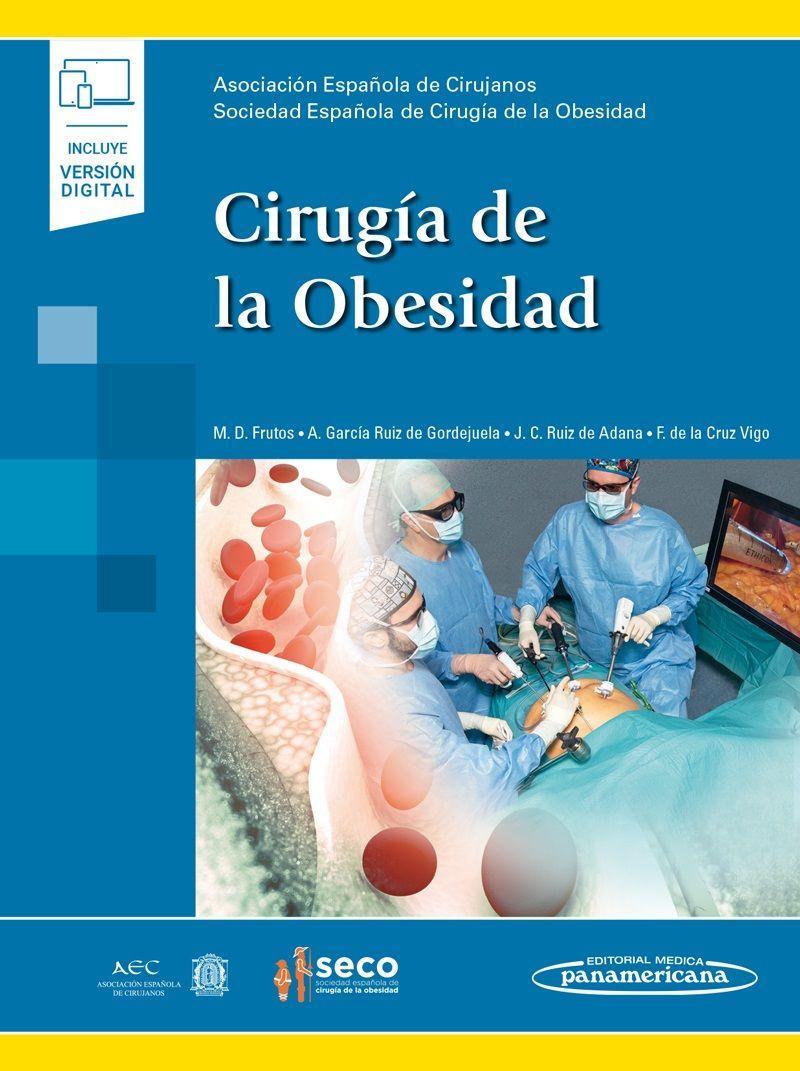 Kniha Cirugía de la Obesidad AEC Asociación Española de Cirujanos
