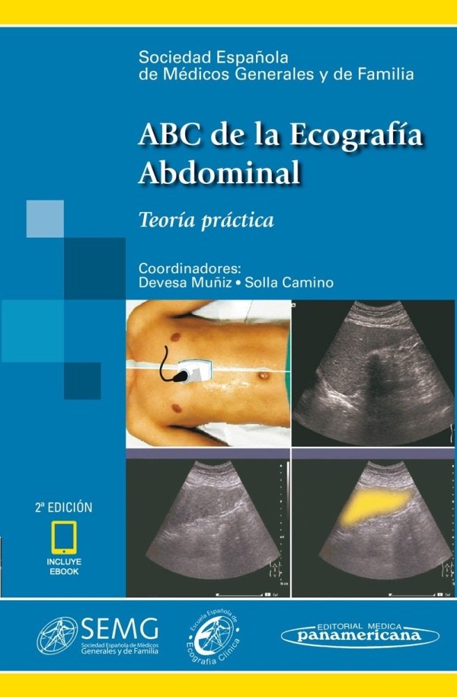 Könyv DEVESA:ABC de la Ecograf'a+e SOCIEDAD ESPAñOLA DE MéDICOS GENERALES Y DE FAMILIA