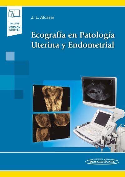 Carte Ecografía en Patología Uterina y Endometrial Alcázar Zambrano