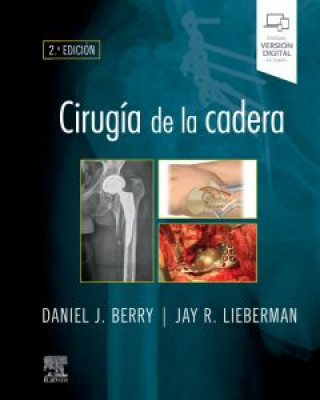 Kniha CIRUGIA DE LA CADERA 2ª ED BERRY