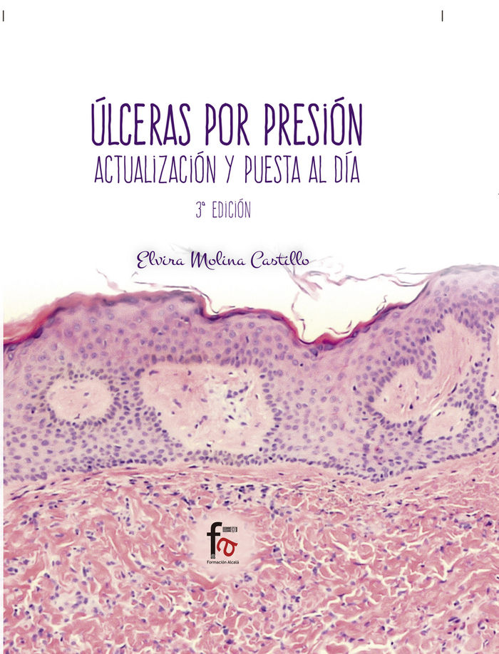 Kniha ULCERAS POR PRESION.-3 EDICION MOLINA CASTILLO