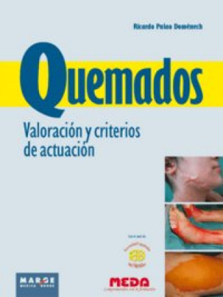 Kniha Quemados. Valoración y criterios de actuación Palao Doménech