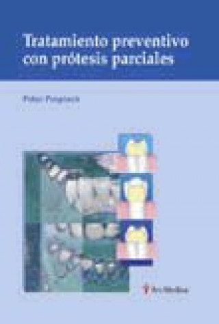 Kniha TRATAMIENTO PREVENTIVO CON PROTESIS PARCIALES POSPIECH