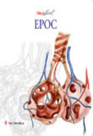 Book EPOC 