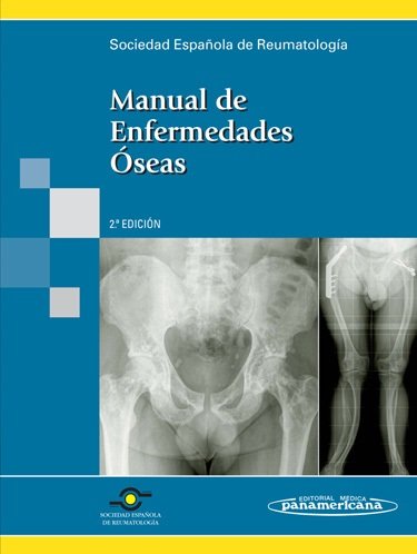 Carte SER:Manual Enfermedades Oseas ARBOLEYA RODRIGUEZ