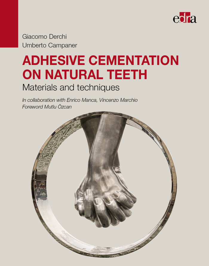 Kniha Adhesive cementation on natural teeth - Materials and techniques Derchi