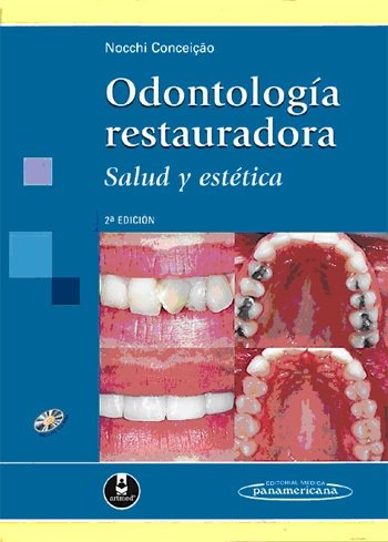 Knjiga NOCCHI:OdontologÆa Restauradora +CD NOCCHI CONCEIÇÇO