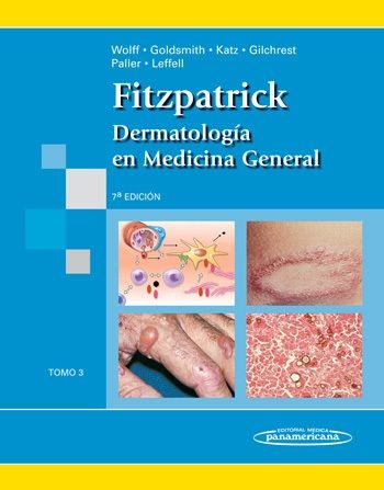 Kniha Fitzpatrick. Dermatolog­a en Medicina General WOLFF
